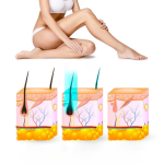 Yui IPLV15 Pro Vücut -Yüz- Bikini Başlıklı Ağrısız Otomatik Ve Manuel Atım Buz Lazer Epilasyon Cihazı